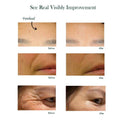 before and after-the result of Anti-Wrinkle Peptide Serum