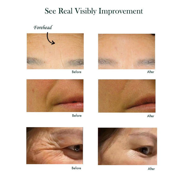 before and after-the result of Anti-Wrinkle Peptide Serum
