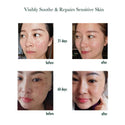 what M-Joptim skin Repair Spray does the visible before and after effective change