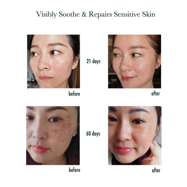 what M-Joptim skin Repair Spray does the visible before and after effective change