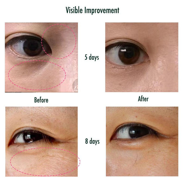 reviews of Eye Patch Mask to see before and after with the powerful visible effect