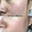 the real view of Ceramide Lotion feedback to before and after using display