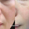 the effective of Skin Rejuvenating Serum to visible anti-aging to see before and after result