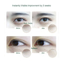Customer reviews of effective eye cream to reduce dark circles and eye bag
