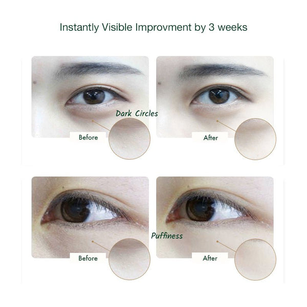 Customer reviews of effective eye cream to reduce dark circles and eye bag
