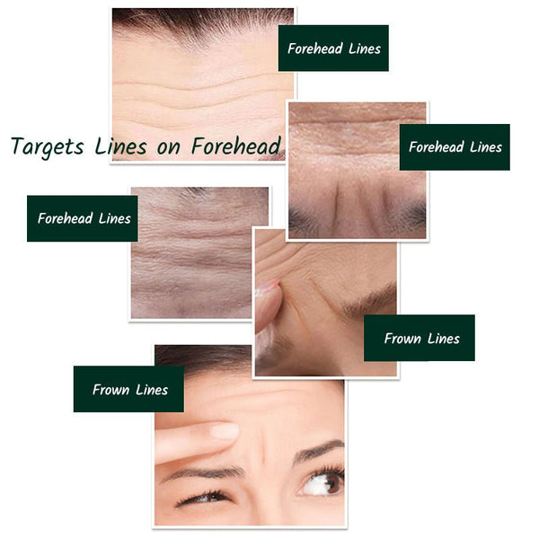 Forehead Wrinkle Patch is to minimize forehead lines and forehead wrinkles and frown lines that are the benefits of anti-wrinkle forehead mask 